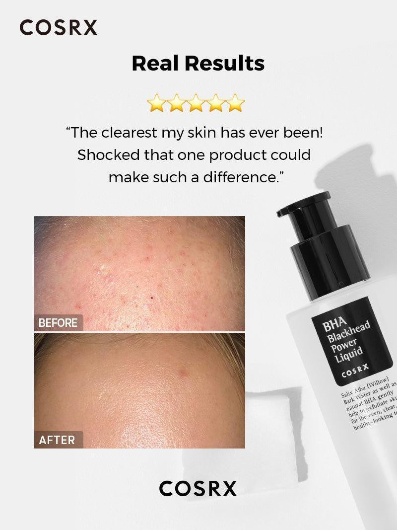 Cosrx BHA Blackhead Power Liquid Toner 50ml