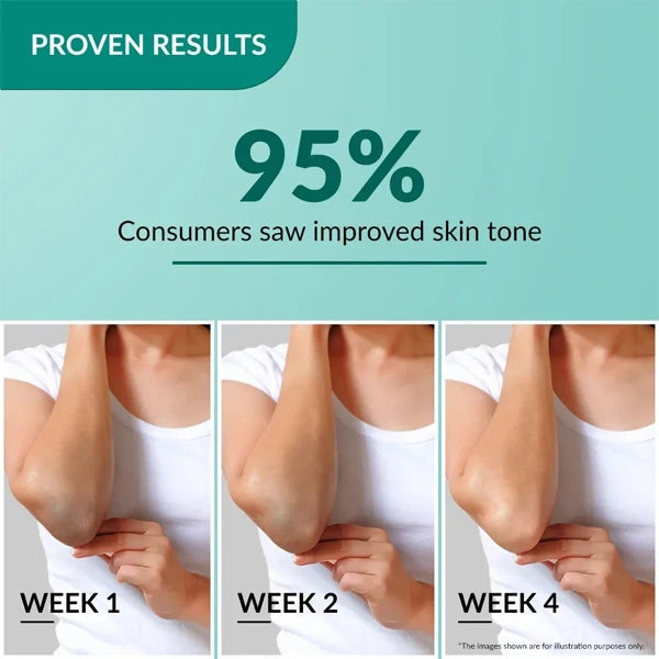Fixderma Nigrifix Cream-50g
