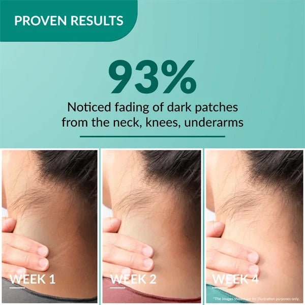 Fixderma Nigrifix Cream-50g