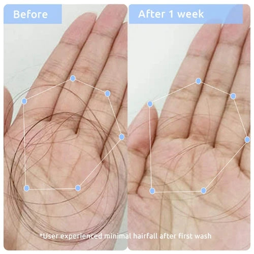 Hair Growth & Anti Hairfall Combo