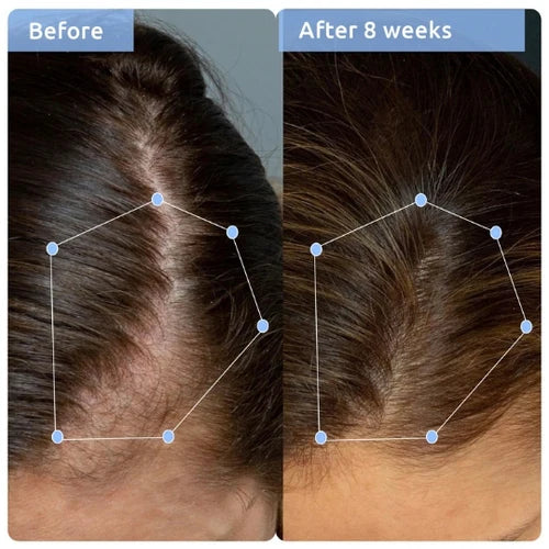 Hair Growth & Anti Hairfall Combo