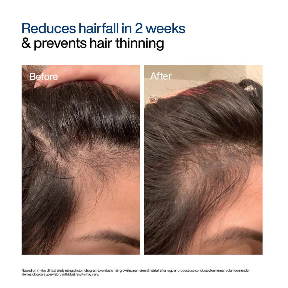 Hair Growth Serum Concentrate Roll-On | 30ml
