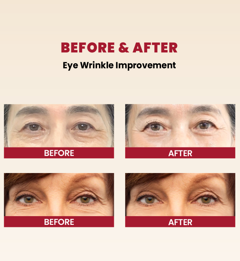 KSECRET - SEOUL 1988 Eye Cream : Retinal Liposome 4% + Fermented Bean 30ml