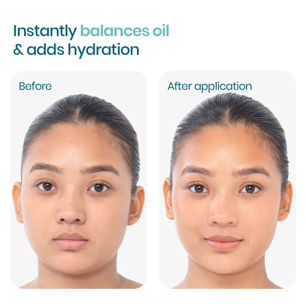 WishCare 2:1:3 NMF Water Gel Moisturizer 50 ML