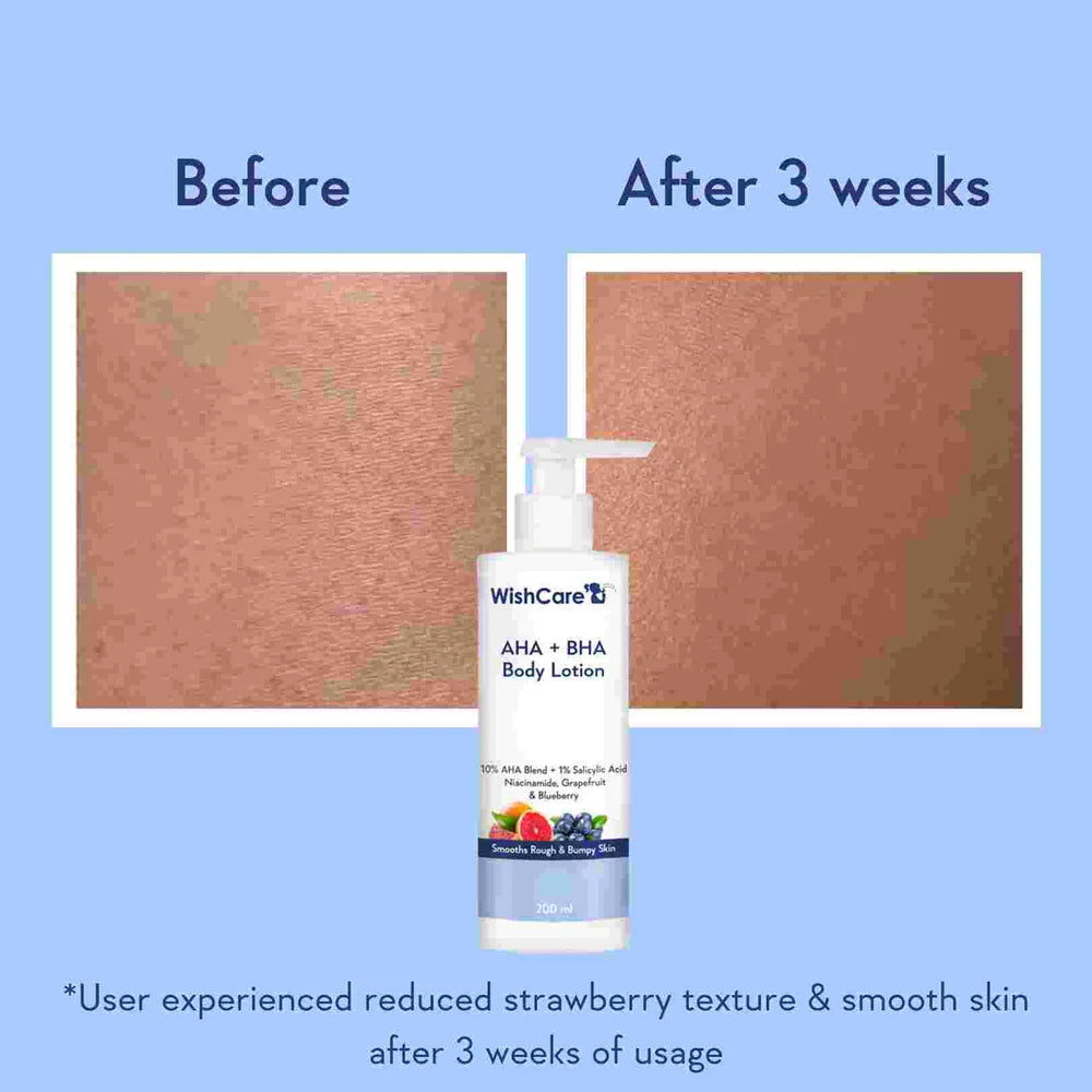 WishCare AHA + BHA Body Lotion 200 ML