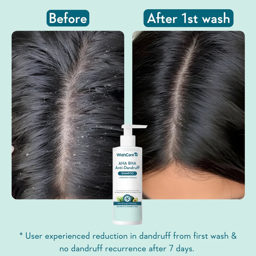 WishCare Anti Dandruff  Combo
