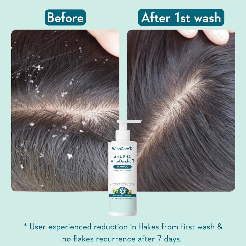 WishCare Anti Dandruff  Combo