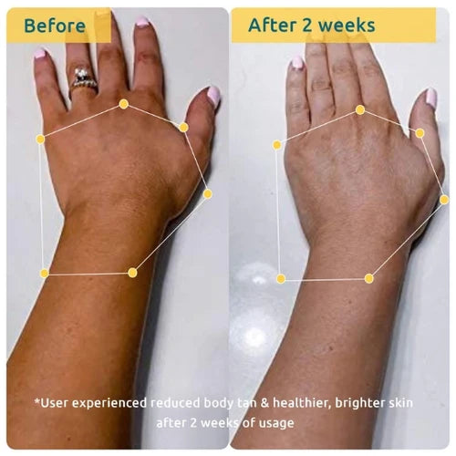WishCare Bodycare Pigmentation Combo