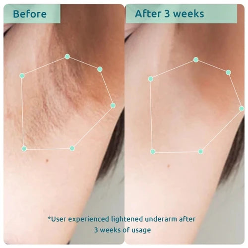 WishCare Bodycare Pigmentation Combo