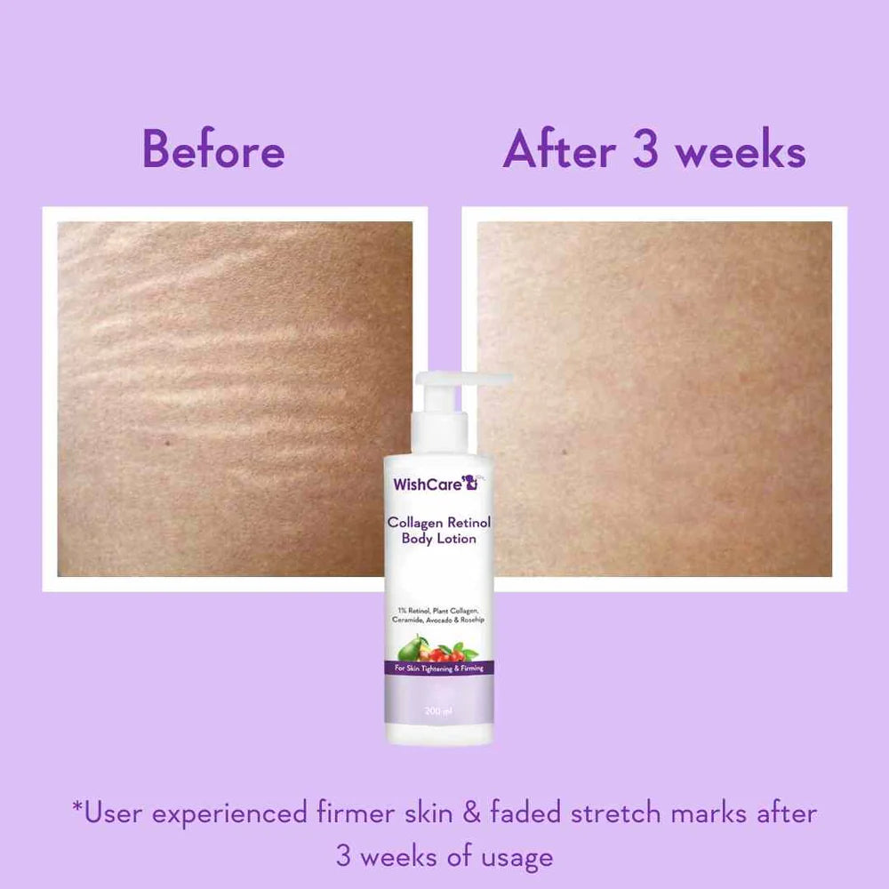 WishCare Collagen 1% Retinol Body Lotion 200 ML