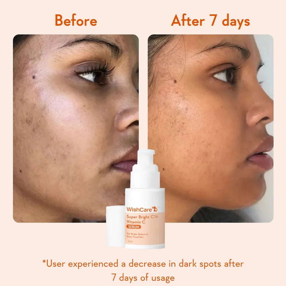 WishCare De-pigmentation Combo