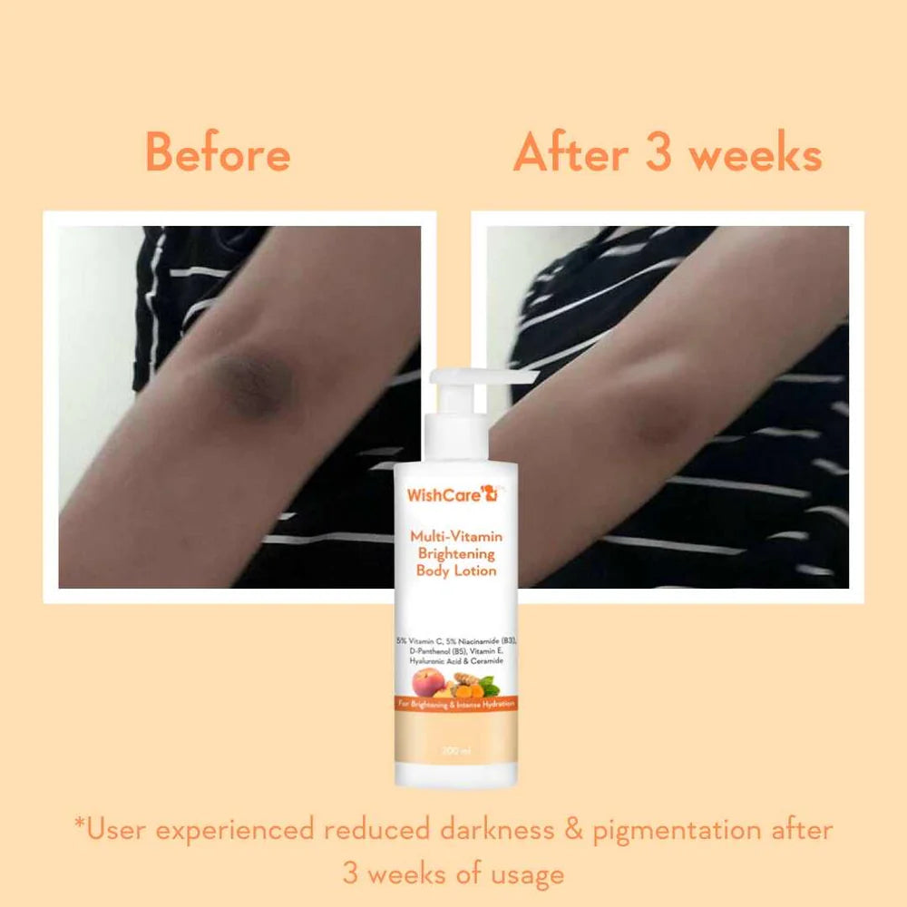 WishCare Multi Vitamin Brightening Body Lotion 200 ML