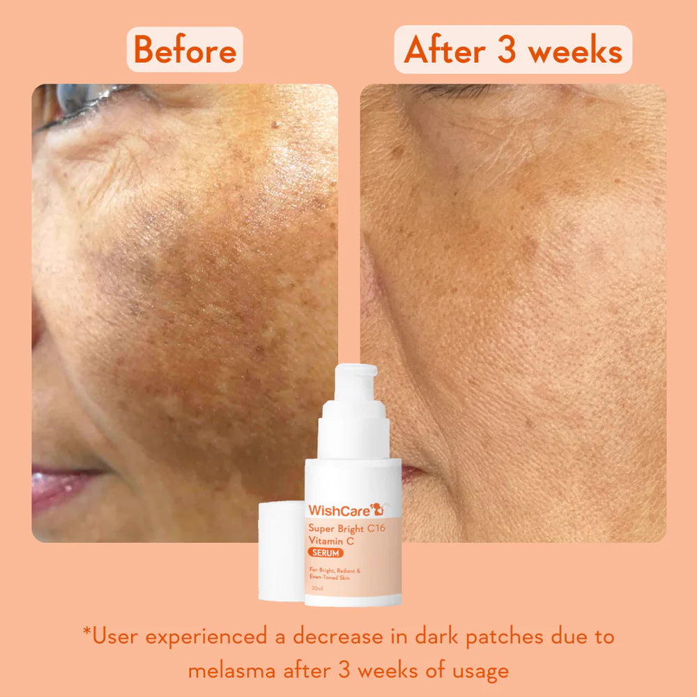 WishCare Super Bright Vitamin C16 Serum 30 ML