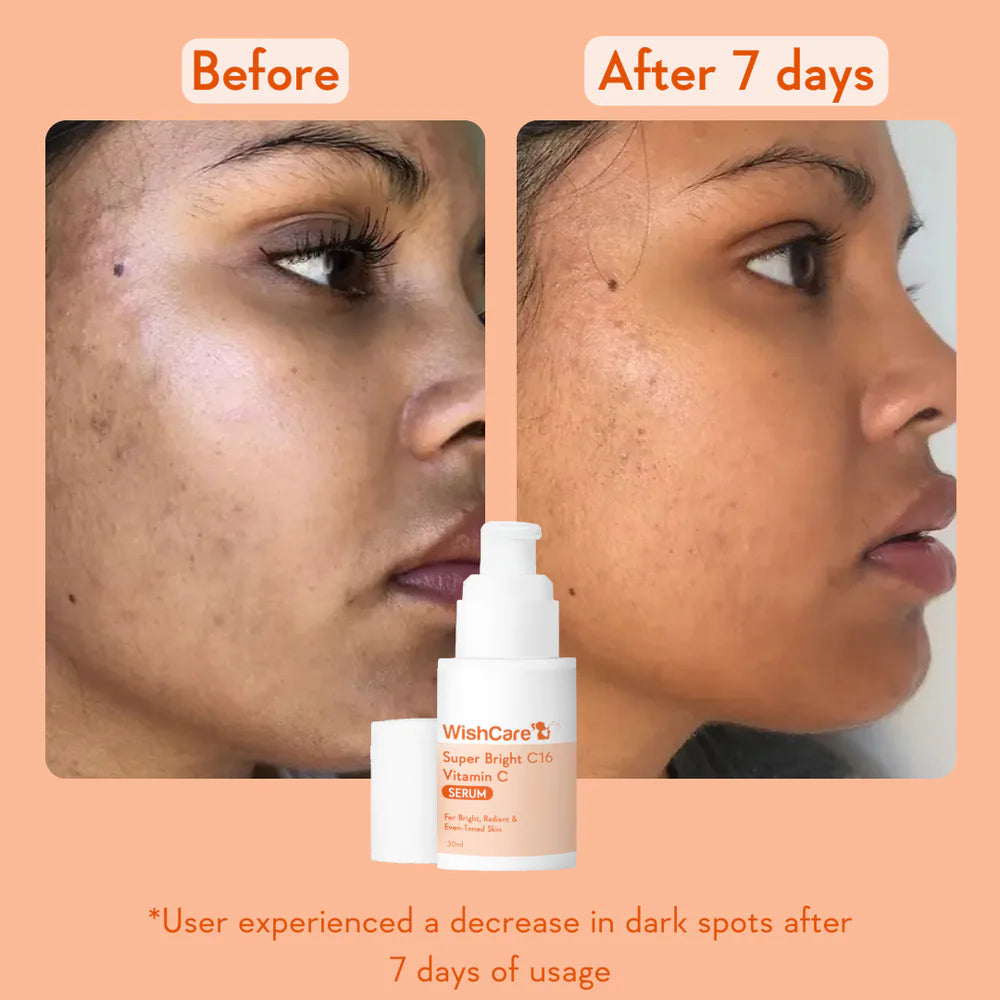 WishCare Super Bright Vitamin C16 Serum 30 ML