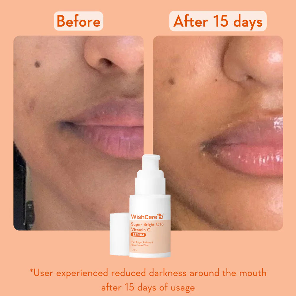 WishCare Super Bright Vitamin C16 Serum 30 ML