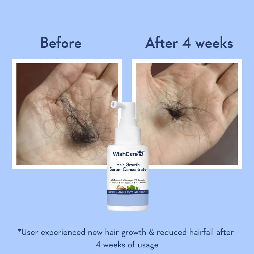 WishCare Hair Growth Serum Concentrate, 30 ML