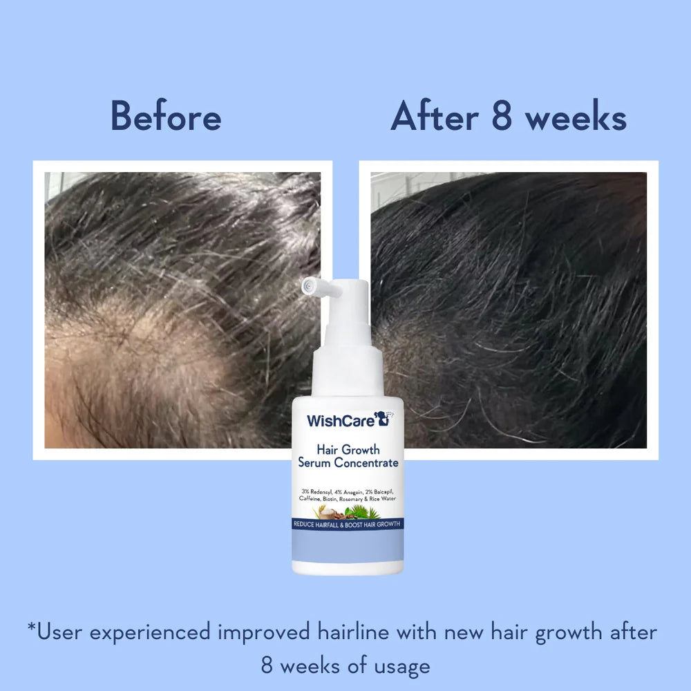 WishCare Hair Growth Serum Concentrate, 30 ML